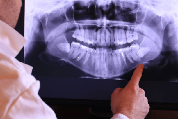 Best Emergency Gum Treatment in Zachary, LA
