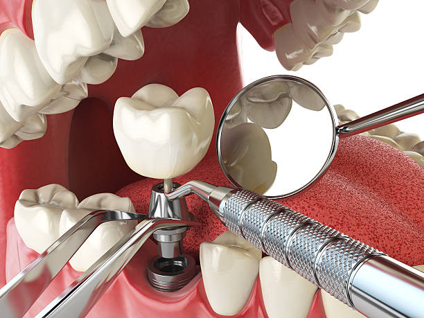Best Pediatric Emergency Dentist in Zachary, LA